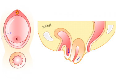 子宮脱・膀胱瘤の検査