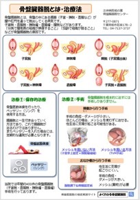 骨盤臓器脱外来と手術の説明：オリジナルの用紙で「分かりやすさ」を 