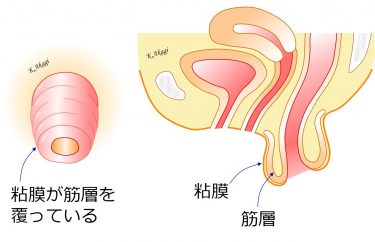 直腸脱手術：術式の使い分けと入院スケジュール